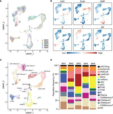 Single-Cell Multiomics Reveals Clonal T-Cell Expansions and Exhaustion in Blastic Plasmacytoid Dendritic Cell Neoplasm